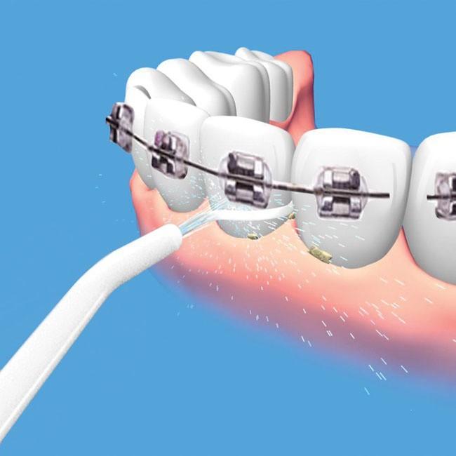 DỤNG CỤ VỆ SINH RĂNG MIỆNG POWER FLOSS 2