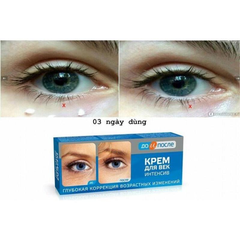 KEM ĐẶC TRỊ VẾT CHÂN CHIM, NẾP NHĂN MẮT KPEM EYE CREAM INSENTIVE