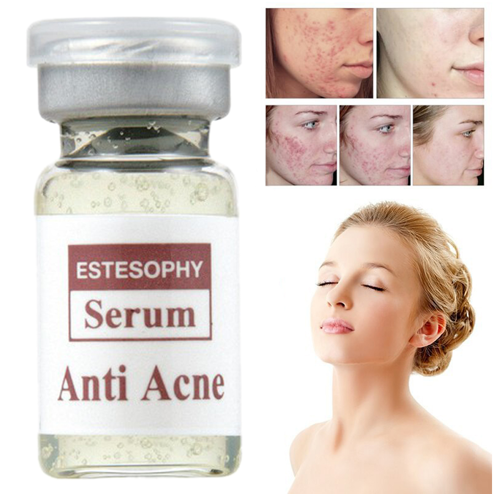 Cách chăm sóc da ngăn ngừa mụn, Serum đặc t rị cho da mụn estesophy giúp tái tạo tế bào da tổn thương và chống mụn 3