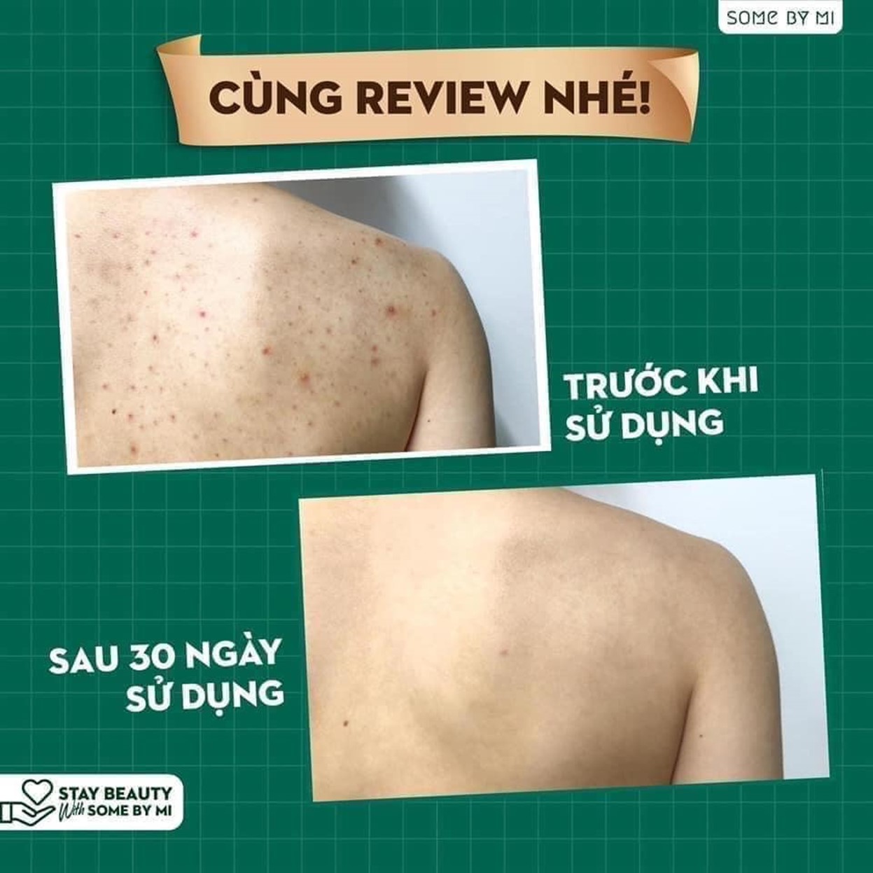 Sữa Tắm Làm Giảm Mụn Cơ Thể Some By Mi AHA-BHA-PHA 30 Days Miracle ...