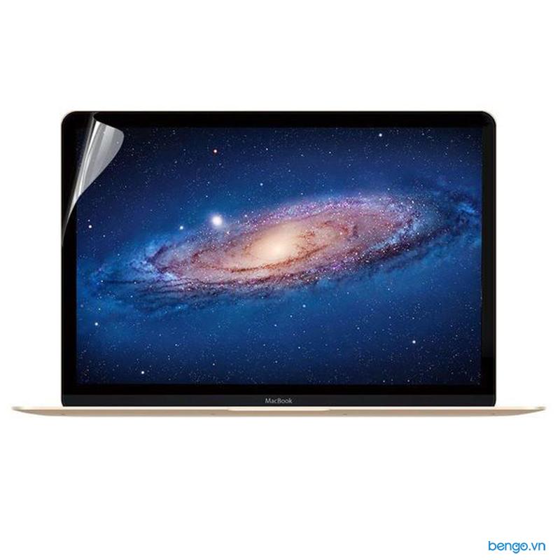 MacGuard JCPAL 5 in 1 for Macbook Pro 13'' 2016 Full Protective