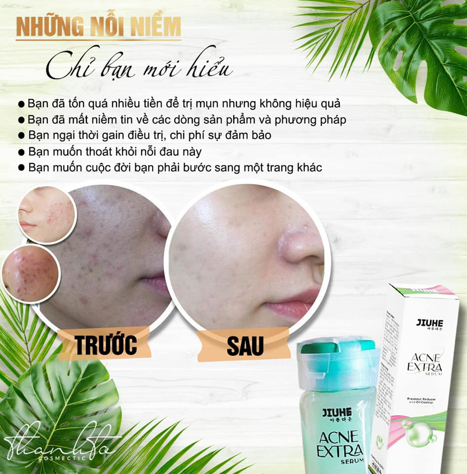 Serum mụn acne extra jiuhe Khử Mụn Viêm , Mụn Đầu Đen , Mờ Thâm